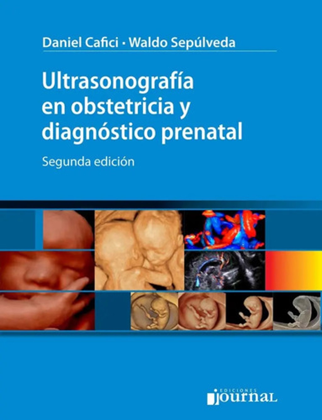 Ultrasonografía En Obstetricia Y Diagnóstico Prenatal