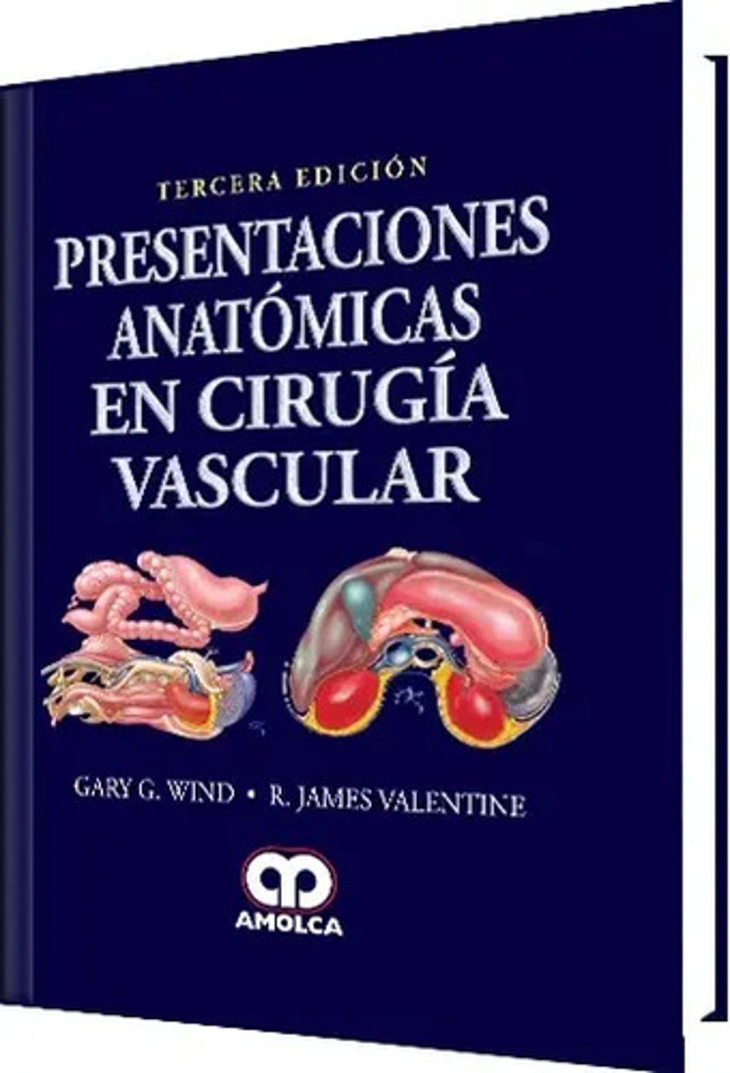 Presentaciones Anatómicas En Cirugía Vascular 3° Edición De Wind Valentine Editorial Amolca Tapa Dura
