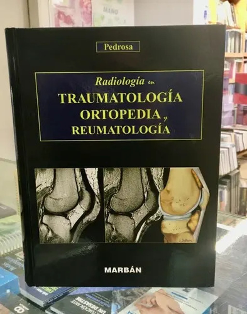 Pedrosa Radiología En Traumatología Ortopedia Y Reum, De Pedrosa Cesar. Editorial Marb{an En Español